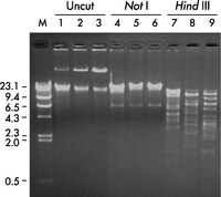 DNA from three different BAC clones from a human chromosome 22 human BAC DNA library (Research Genetics, Inc.) was purified with the Montage Plasmid Miniprep<sub>HTS</sub> 96 Kit and electrophoresed on a 0.8% agarose gel for 120 min at 100 V either uncut (lanes 1 – 3) or after digestion with Not I (lanes 4 – 6) or <i>Hin</i>d III (lanes 7 – 9). Lane M is a <i>Hin</i>d III digest of Lambda phage DNA. The BAC DNA purified with the Montage Plasmid Miniprep<sub>HTS</sub> 96 Kit is suitable for fingerprinting.